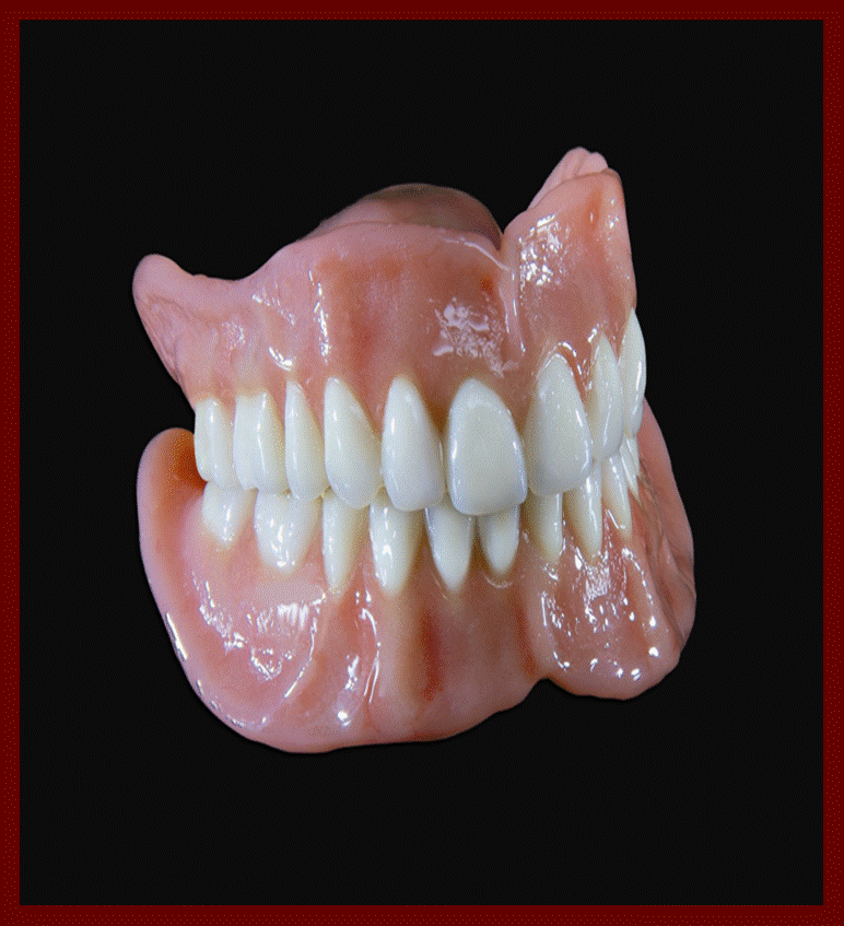 crown preop